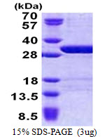 USP15 Protein