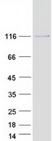 USP15 Protein - Purified recombinant protein USP15 was analyzed by SDS-PAGE gel and Coomassie Blue Staining