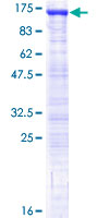 USP16 Protein - 12.5% SDS-PAGE of human USP16 stained with Coomassie Blue