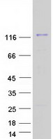USP16 Protein - Purified recombinant protein USP16 was analyzed by SDS-PAGE gel and Coomassie Blue Staining
