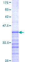 USP17L2 / DUB3 Protein - 12.5% SDS-PAGE Stained with Coomassie Blue.