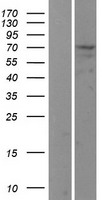 USP2 Protein - Western validation with an anti-DDK antibody * L: Control HEK293 lysate R: Over-expression lysate