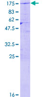 USP20 / VDU2 Protein - 12.5% SDS-PAGE of human USP20 stained with Coomassie Blue