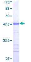 USP20 / VDU2 Protein - 12.5% SDS-PAGE Stained with Coomassie Blue.