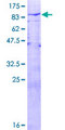 USP21 Protein - 12.5% SDS-PAGE of human USP21 stained with Coomassie Blue