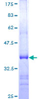 USP21 Protein - 12.5% SDS-PAGE Stained with Coomassie Blue.