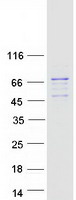 USP21 Protein - Purified recombinant protein USP21 was analyzed by SDS-PAGE gel and Coomassie Blue Staining