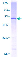USP24 Protein - 12.5% SDS-PAGE of human USP24 stained with Coomassie Blue