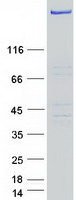 USP24 Protein - Purified recombinant protein USP24 was analyzed by SDS-PAGE gel and Coomassie Blue Staining