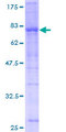 USP25 Protein - 12.5% SDS-PAGE of human USP25 stained with Coomassie Blue