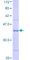 USP26 Protein - 12.5% SDS-PAGE Stained with Coomassie Blue.