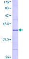 USP26 Protein - 12.5% SDS-PAGE Stained with Coomassie Blue.