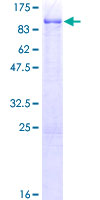USP28 Protein - 12.5% SDS-PAGE of human USP28 stained with Coomassie Blue