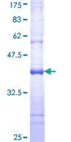 USP28 Protein - 12.5% SDS-PAGE Stained with Coomassie Blue.