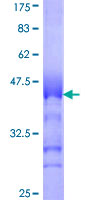 USP29 Protein - 12.5% SDS-PAGE Stained with Coomassie Blue.