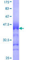 USP29 Protein - 12.5% SDS-PAGE Stained with Coomassie Blue.
