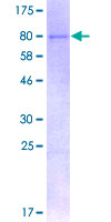 USP3 / UBP Protein - 12.5% SDS-PAGE of human USP3 stained with Coomassie Blue