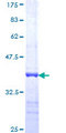 USP3 / UBP Protein - 12.5% SDS-PAGE Stained with Coomassie Blue.