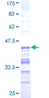 USP31 Protein - 12.5% SDS-PAGE Stained with Coomassie Blue.