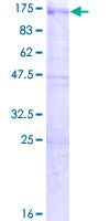 USP33 / VDU1 Protein - 12.5% SDS-PAGE of human USP33 stained with Coomassie Blue