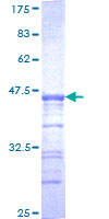USP33 / VDU1 Protein - 12.5% SDS-PAGE Stained with Coomassie Blue.