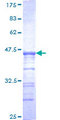 USP33 / VDU1 Protein - 12.5% SDS-PAGE Stained with Coomassie Blue.