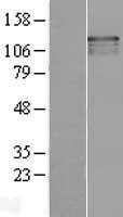 USP37 Protein - Western validation with an anti-DDK antibody * L: Control HEK293 lysate R: Over-expression lysate
