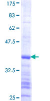 USP37 Protein - 12.5% SDS-PAGE Stained with Coomassie Blue.