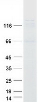 USP37 Protein - Purified recombinant protein USP37 was analyzed by SDS-PAGE gel and Coomassie Blue Staining