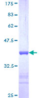 USP39 Protein - 12.5% SDS-PAGE Stained with Coomassie Blue.