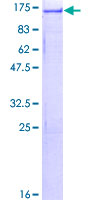 USP4 Protein - 12.5% SDS-PAGE of human USP4 stained with Coomassie Blue