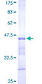 USP4 Protein - 12.5% SDS-PAGE Stained with Coomassie Blue.