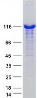 USP4 Protein - Purified recombinant protein USP4 was analyzed by SDS-PAGE gel and Coomassie Blue Staining