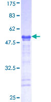 USP42 Protein - 12.5% SDS-PAGE Stained with Coomassie Blue.