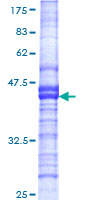 USP43 Protein - 12.5% SDS-PAGE Stained with Coomassie Blue.