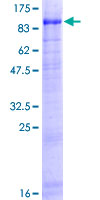USP44 Protein - 12.5% SDS-PAGE of human USP44 stained with Coomassie Blue