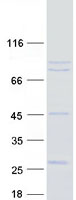 USP44 Protein - Purified recombinant protein USP44 was analyzed by SDS-PAGE gel and Coomassie Blue Staining