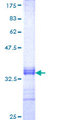 USP45 Protein - 12.5% SDS-PAGE Stained with Coomassie Blue.