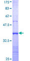 USP46 Protein - 12.5% SDS-PAGE Stained with Coomassie Blue.