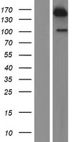 USP47 Protein - Western validation with an anti-DDK antibody * L: Control HEK293 lysate R: Over-expression lysate