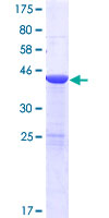 USP47 Protein - 12.5% SDS-PAGE of human USP47 stained with Coomassie Blue