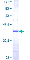 USP47 Protein - 12.5% SDS-PAGE Stained with Coomassie Blue.