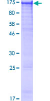 USP48 Protein - 12.5% SDS-PAGE of human USP48 stained with Coomassie Blue