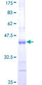 USP48 Protein - 12.5% SDS-PAGE Stained with Coomassie Blue.