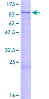 USP49 Protein - 12.5% SDS-PAGE of human USP49 stained with Coomassie Blue