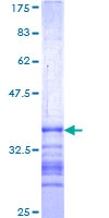 USP49 Protein - 12.5% SDS-PAGE Stained with Coomassie Blue.