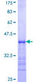 USP5 Protein - 12.5% SDS-PAGE Stained with Coomassie Blue.