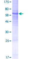 USP50 Protein - 12.5% SDS-PAGE of human USP50 stained with Coomassie Blue
