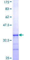 USP51 Protein - 12.5% SDS-PAGE Stained with Coomassie Blue.