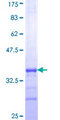 USP51 Protein - 12.5% SDS-PAGE Stained with Coomassie Blue.